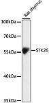 Western blot - STK26 Rabbit pAb (A16534)