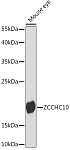 Western blot - ZCCHC10 Rabbit pAb (A16539)