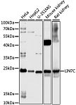 Western blot - LIN7C Rabbit pAb (A16544)