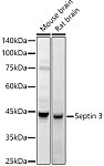 Western blot - Septin 3 Rabbit pAb (A16551)