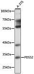 Western blot - PDSS2 Rabbit pAb (A16557)