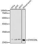 Western blot - STARD3NL Rabbit pAb (A16579)