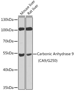 Carbonic Anhydrase 9 (CA9/G250) Rabbit pAb