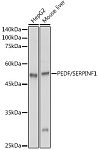 Western blot - PEDF/SERPINF1 Rabbit pAb (A1673)