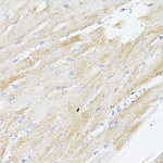 Western blot - BMPR2 Rabbit pAb (A16778)