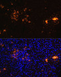 Immunofluorescence - CD70 Rabbit pAb (A16809)