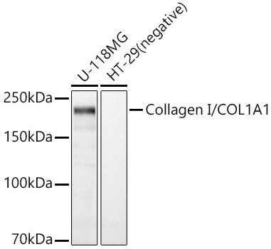 Collagen I/COL1A1 Rabbit pAb-Polyclonal Antibodies - ABclonal