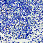 Western blot - NFAT2 Rabbit pAb (A16928)