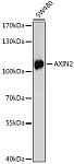 Western blot - AXIN2 Rabbit pAb (A17022)