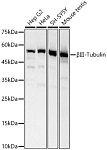 Western blot - βIII-Tubulin Rabbit pAb (A17073)