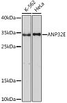 Western blot - ANP32E Rabbit pAb (A17220)