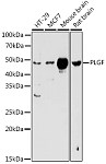 Western blot - PLGF Rabbit pAb (A1727)