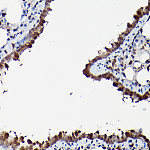 Western blot - MAPK1/MAPK3 Rabbit pAb (A17291)
