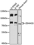 Western blot - ZDHHC8 Rabbit pAb (A17348)