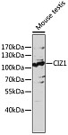 Western blot - CIZ1 Rabbit pAb (A17349)