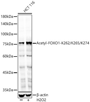 Acetyl-FOXO1-K262/K265/K274 Rabbit pAb