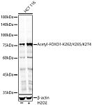 Western blot - Acetyl-FOXO1-K262/K265/K274 Rabbit pAb (A17406)