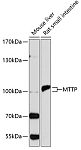 Western blot - MTTP Rabbit pAb (A1746)