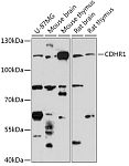 Western blot - CDHR1 Rabbit pAb (A17808)
