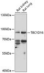 Western blot - TBC1D16 Rabbit pAb (A17820)