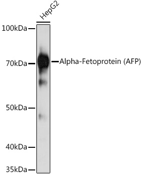 Alpha-Fetoprotein (AFP) Mouse mAb