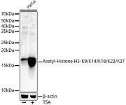 Western blot - Acetyl-Histone H3-K9/K14/K18/K23/K27 Rabbit pAb (A17917)