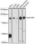 Western blot - pan-PKC Rabbit pAb (A17922)