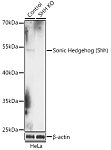 Western blot - [KO Validated] Sonic Hedgehog (Shh) Rabbit pAb (A18020)
