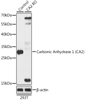 [KO Validated] Carbonic Anhydrase 2 (CA2) Rabbit pAb