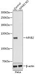 Western blot - [KO Validated] NF-κB2 Rabbit pAb (A18039)