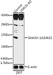 Western blot - [KO Validated] Galectin 1/LGALS1 Rabbit pAb (A18040)