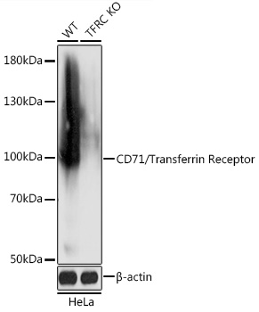 [KO Validated] CD71/Transferrin Receptor Rabbit pAb
