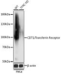 Western blot - [KO Validated] CD71/Transferrin Receptor Rabbit pAb (A18083)