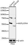 Western blot - [KO Validated] MST1/STK4 Rabbit pAb (A18100)