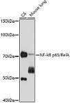 Western blot - NF-kB p65/RelA Mouse mAb (A18210)