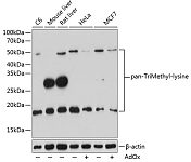 Western blot - pan-TriMethyl-lysine Rabbit pAb (A18292)