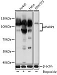 Western blot - PARP1 Mouse mAb (A18303)