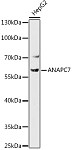 Western blot - ANAPC7 Rabbit pAb (A18459)