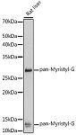 Western blot - pan-Myristyl-G Rabbit pAb (A18599)