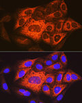 Immunofluorescence - TACC3 Rabbit pAb (A18641)