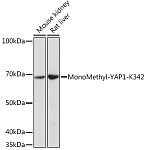 Western blot - MonoMethyl-YAP1-K342 Rabbit pAb (A18651)