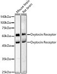 Western blot - Oxytocin Receptor Rabbit pAb (A18686)