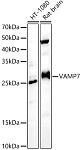 Western blot - VAMP7 Rabbit pAb (A18698)