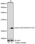 Western blot - Lactic acid-Histone H3-K27 Rabbit pAb (A18825)