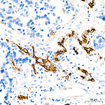 Western blot - CD105/Endoglin Rabbit mAb (A19008)