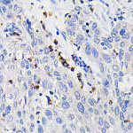 Immunohistochemistry - CD11b/ITGAM Rabbit mAb (A19010)
