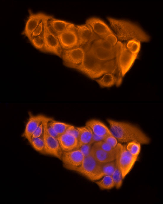 Cytokeratin 19 (CK19) Rabbit mAb