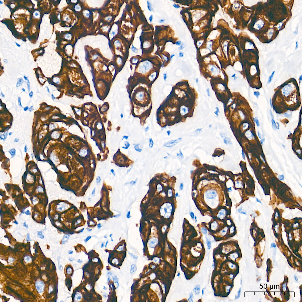 Cytokeratin 19 (CK19) Rabbit mAb