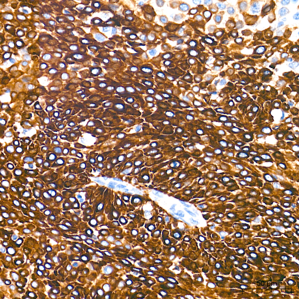 Cytokeratin 19 (CK19) Rabbit mAb