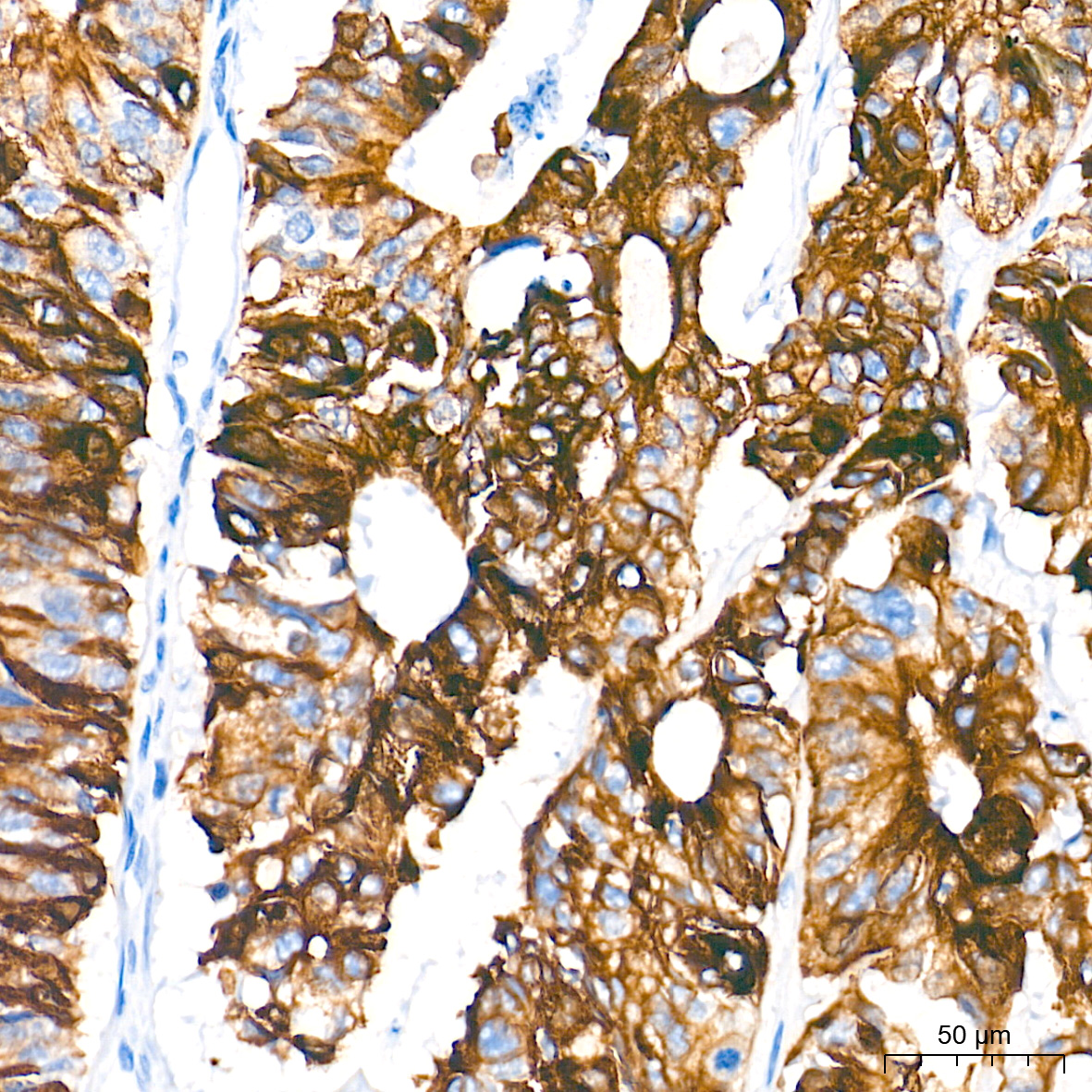 Cytokeratin 19 (CK19) Rabbit mAb